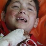Children suffering in Gaza